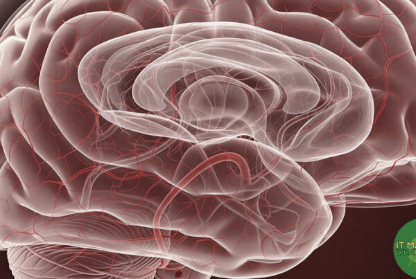 Normal Pressure Hydrocephalu